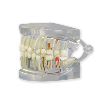 Clear Human Jaw with Teeth Model