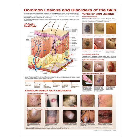 Common Lesions and Disorders of the Skin