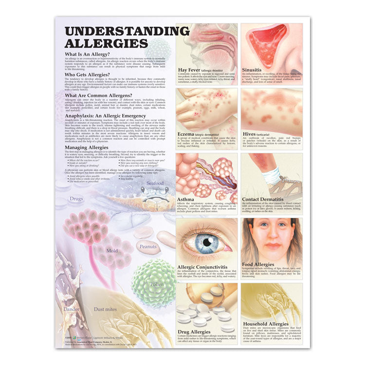 Understanding Allergies Chart