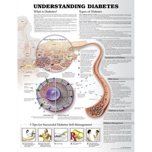 Understanding Diabetes