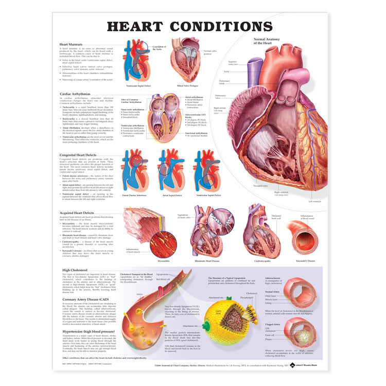 Heart Conditions