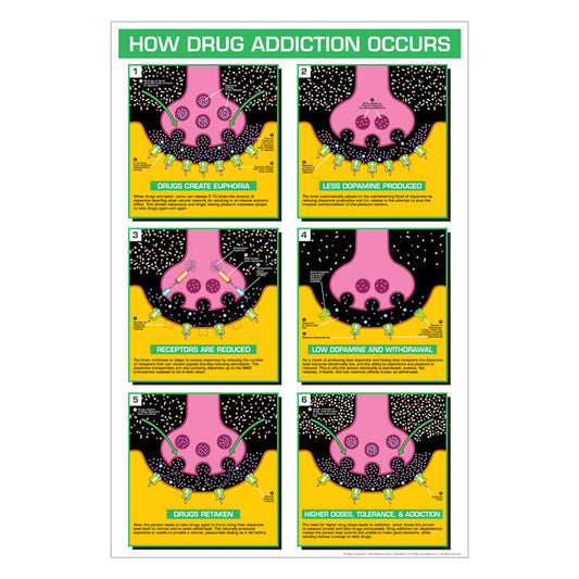 Drug Education Posters - How Drug Addiction Occurs