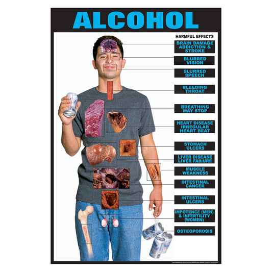 Drug Awareness Poster Collection: Alcohol