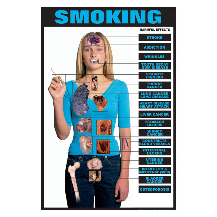 Drug Awareness Poster Collection: Smoking