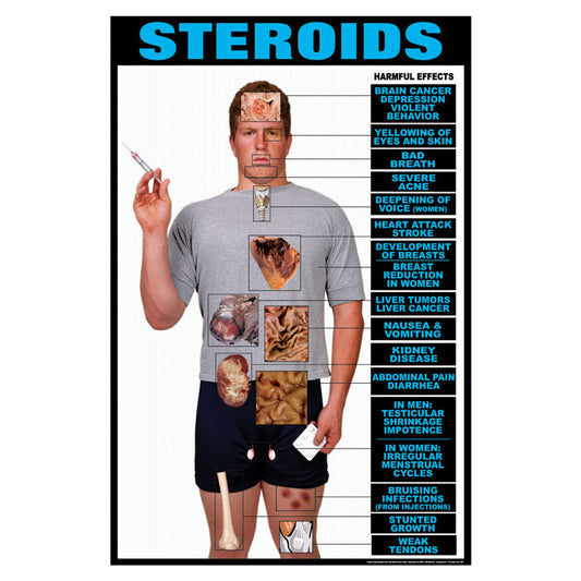 Drug Awareness Poster Collection: Steroids