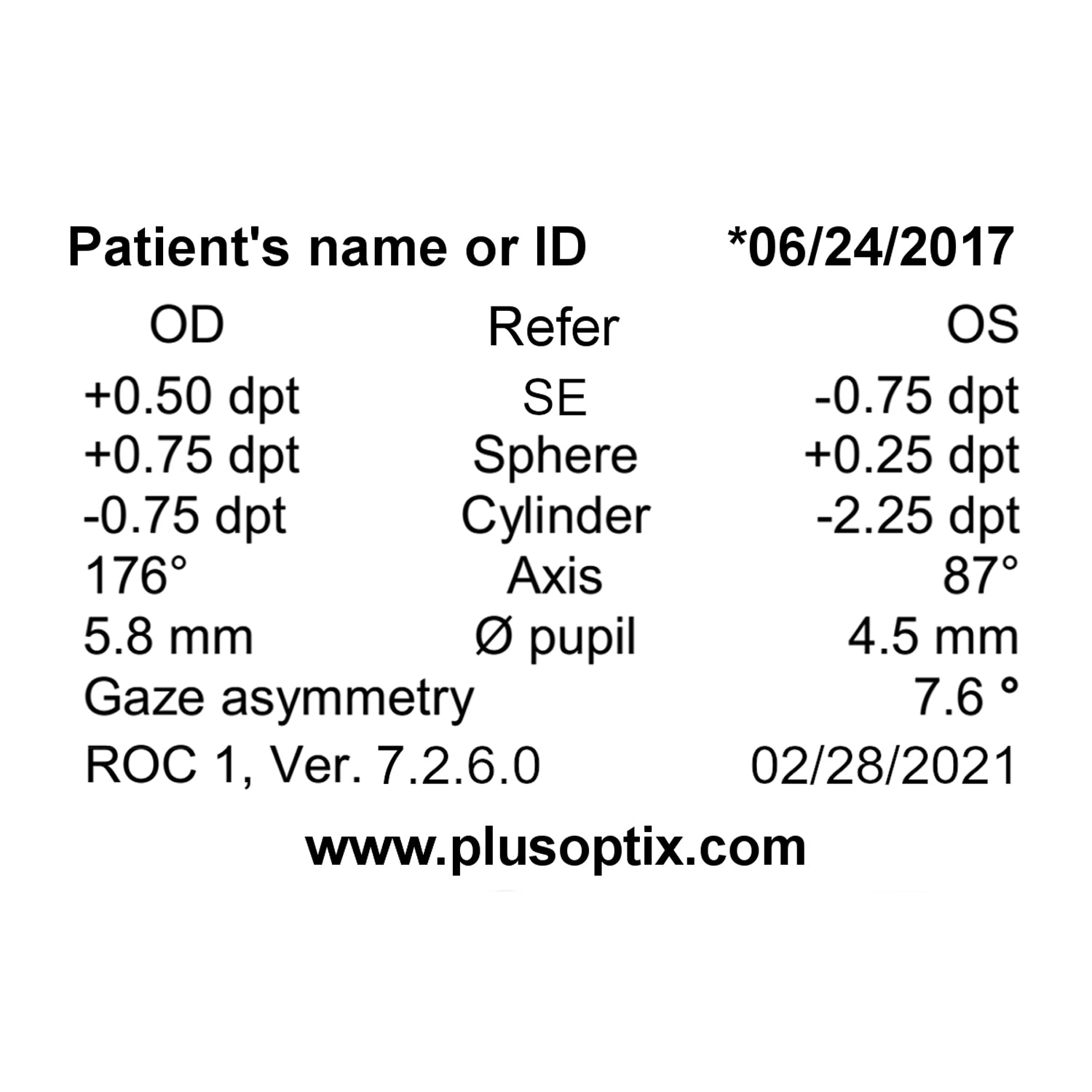 79119 Plusoptix chart