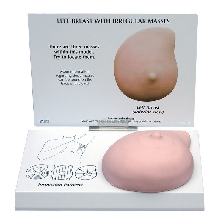 Left Breast with Irregular Masses Anatomical Model