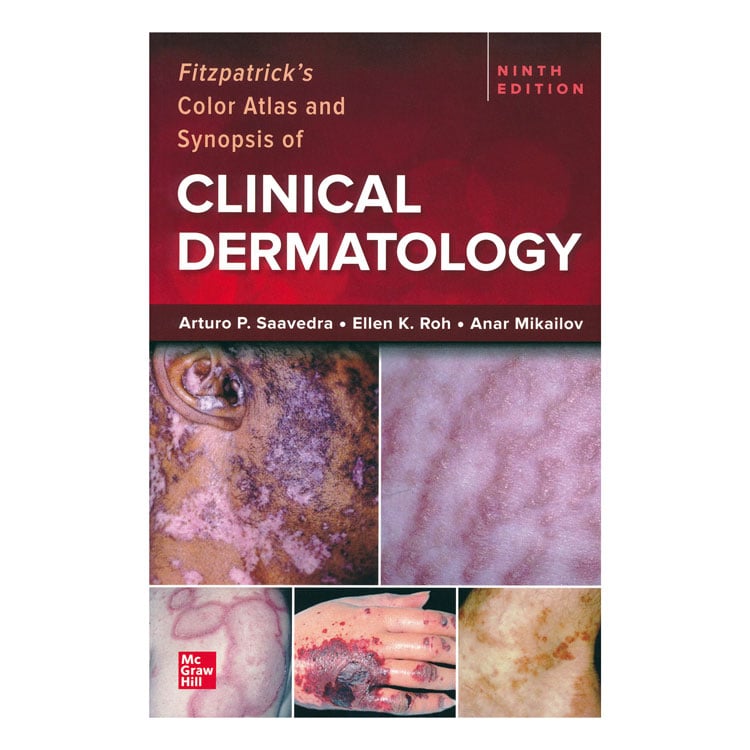 Fitzpatrick's Color Atlas and Synopsis of Clinical Dermatology